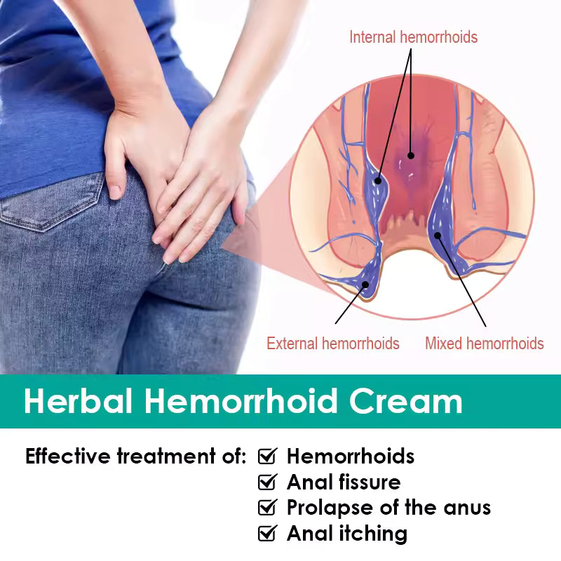 crème médicinale pour l'hémorroïdes
