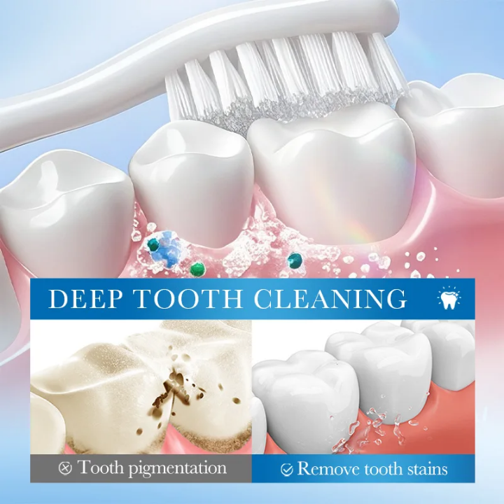 Gel de blanchiment dentaires